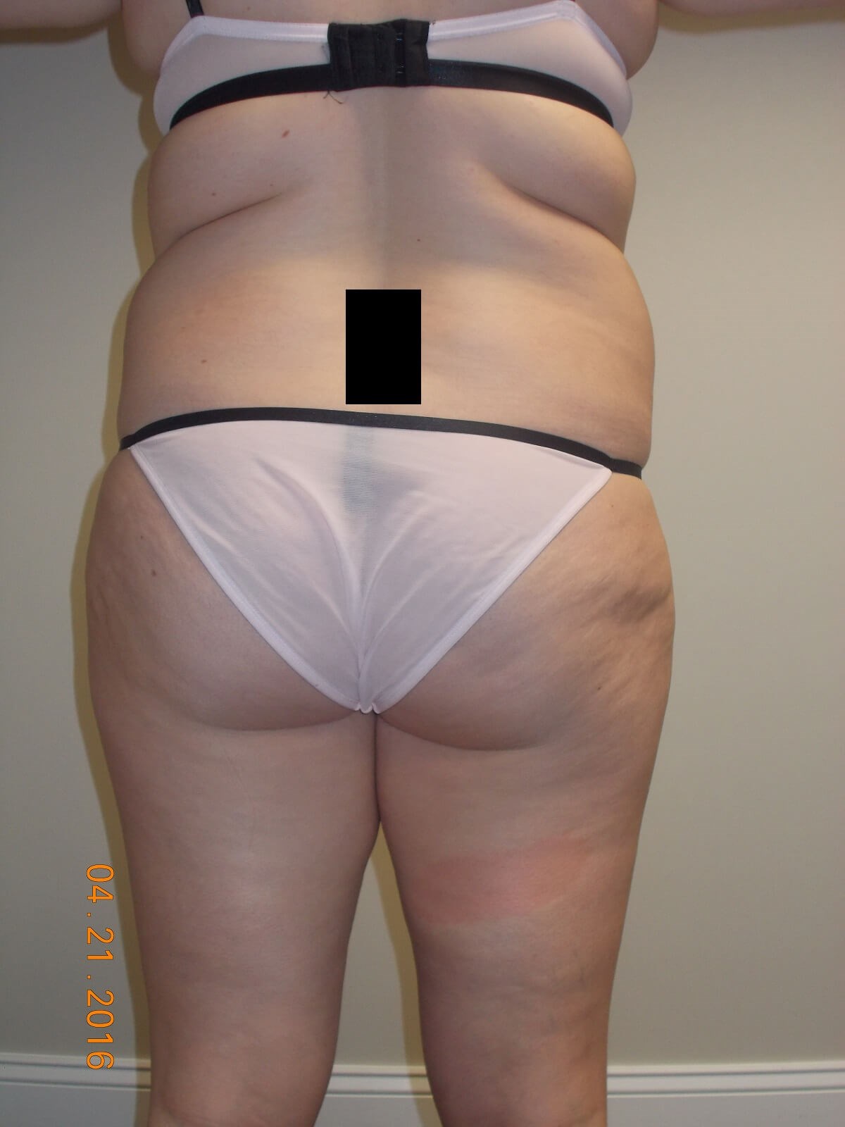 Back View Before