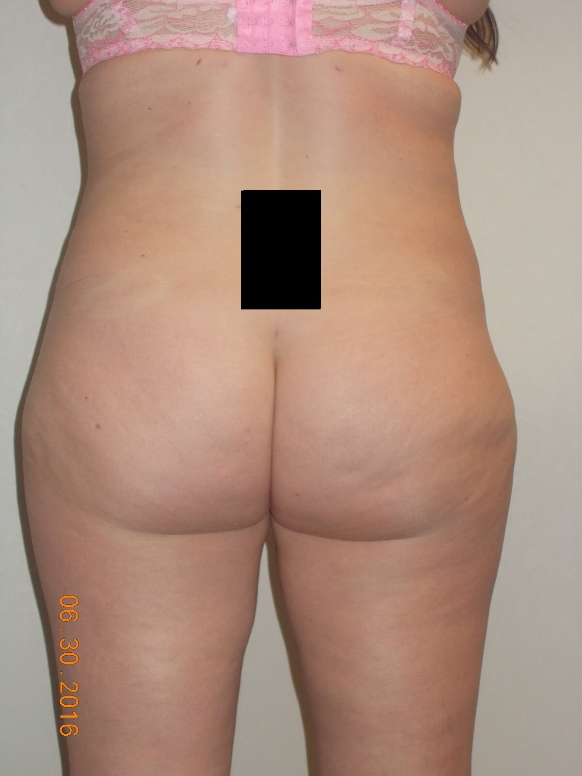 Back View After