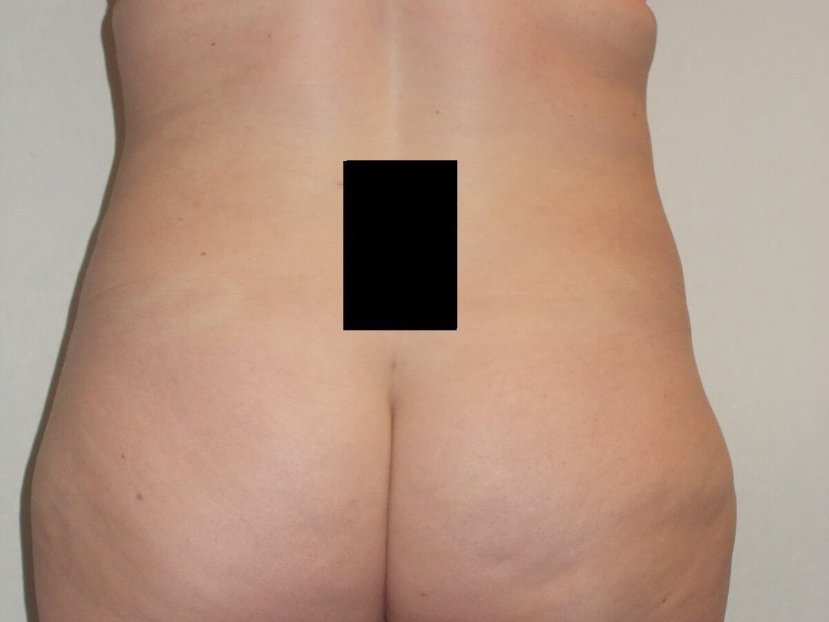 Back View After