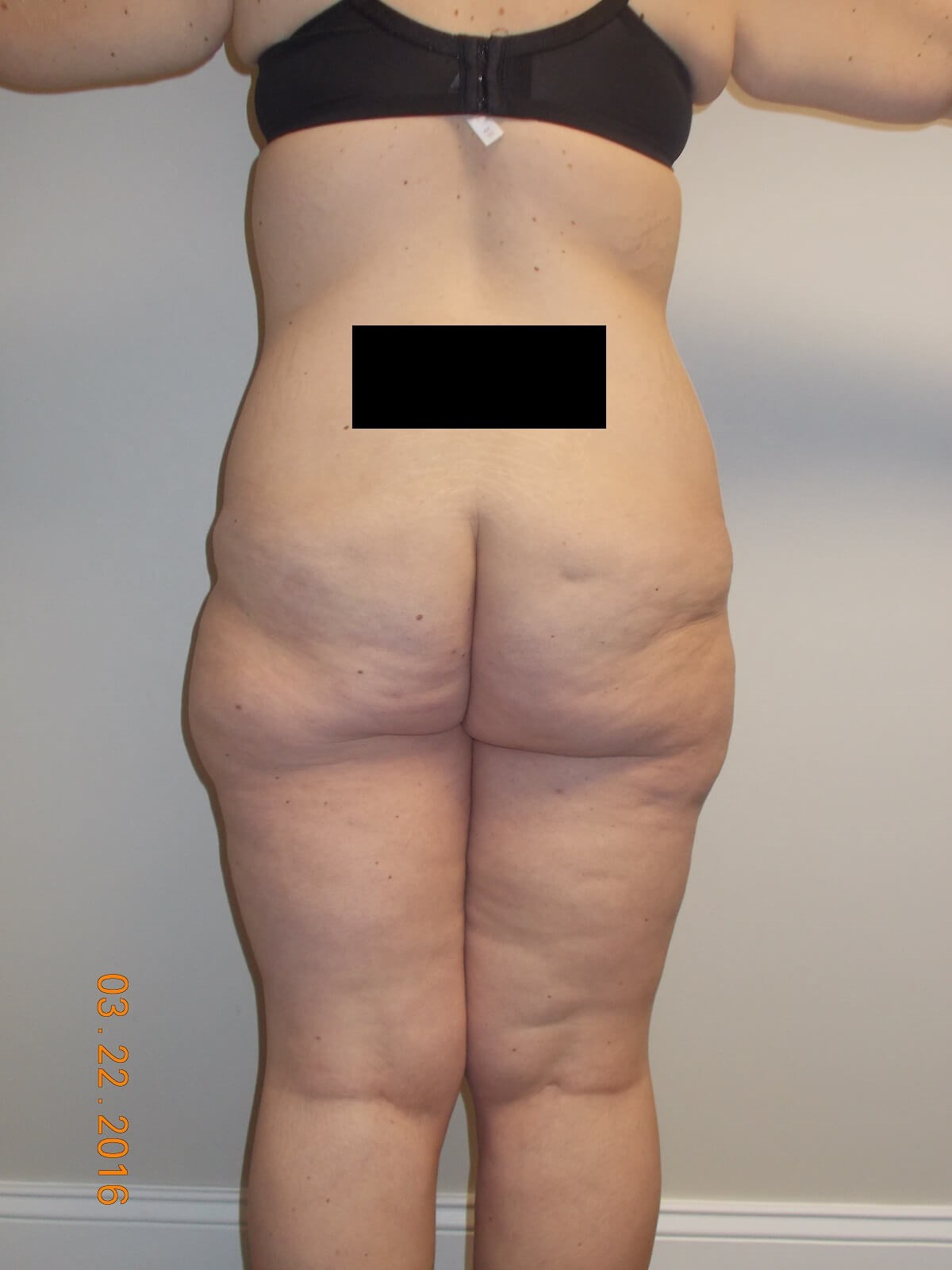 Back View Before