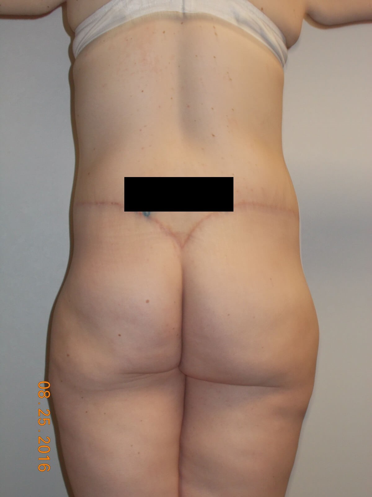 Back View After