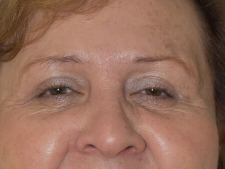 Front After