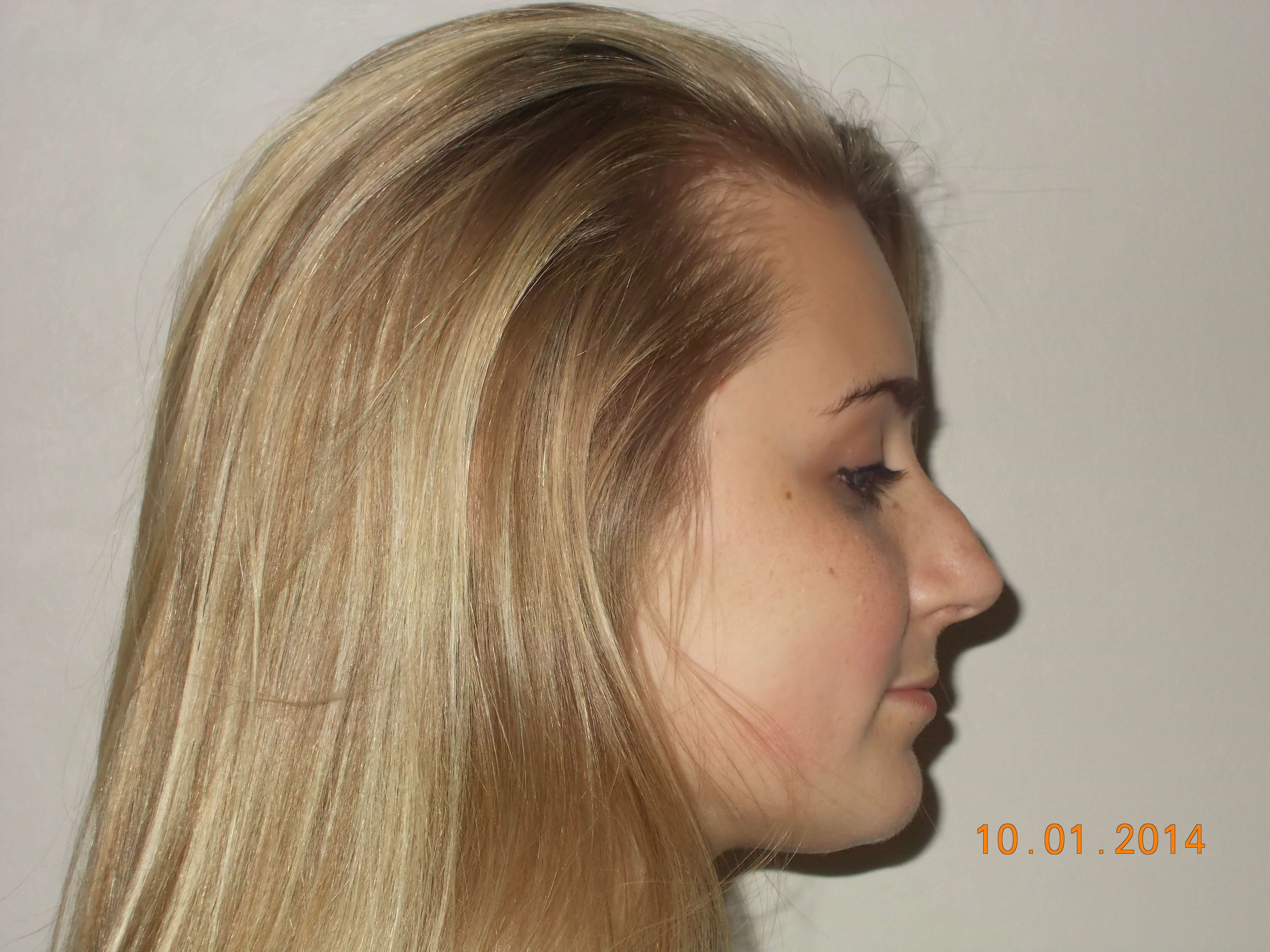 Before Image