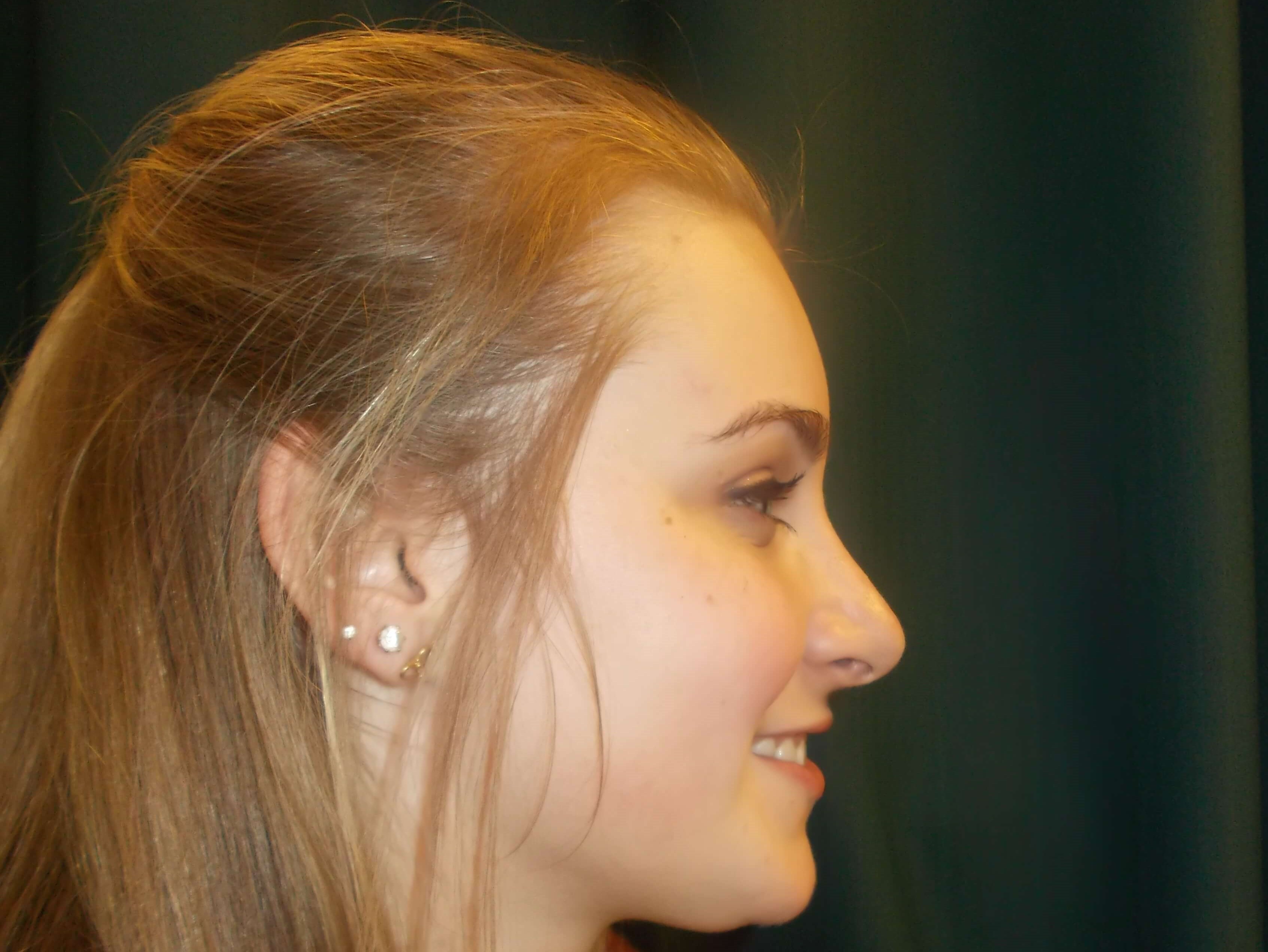 Side View After