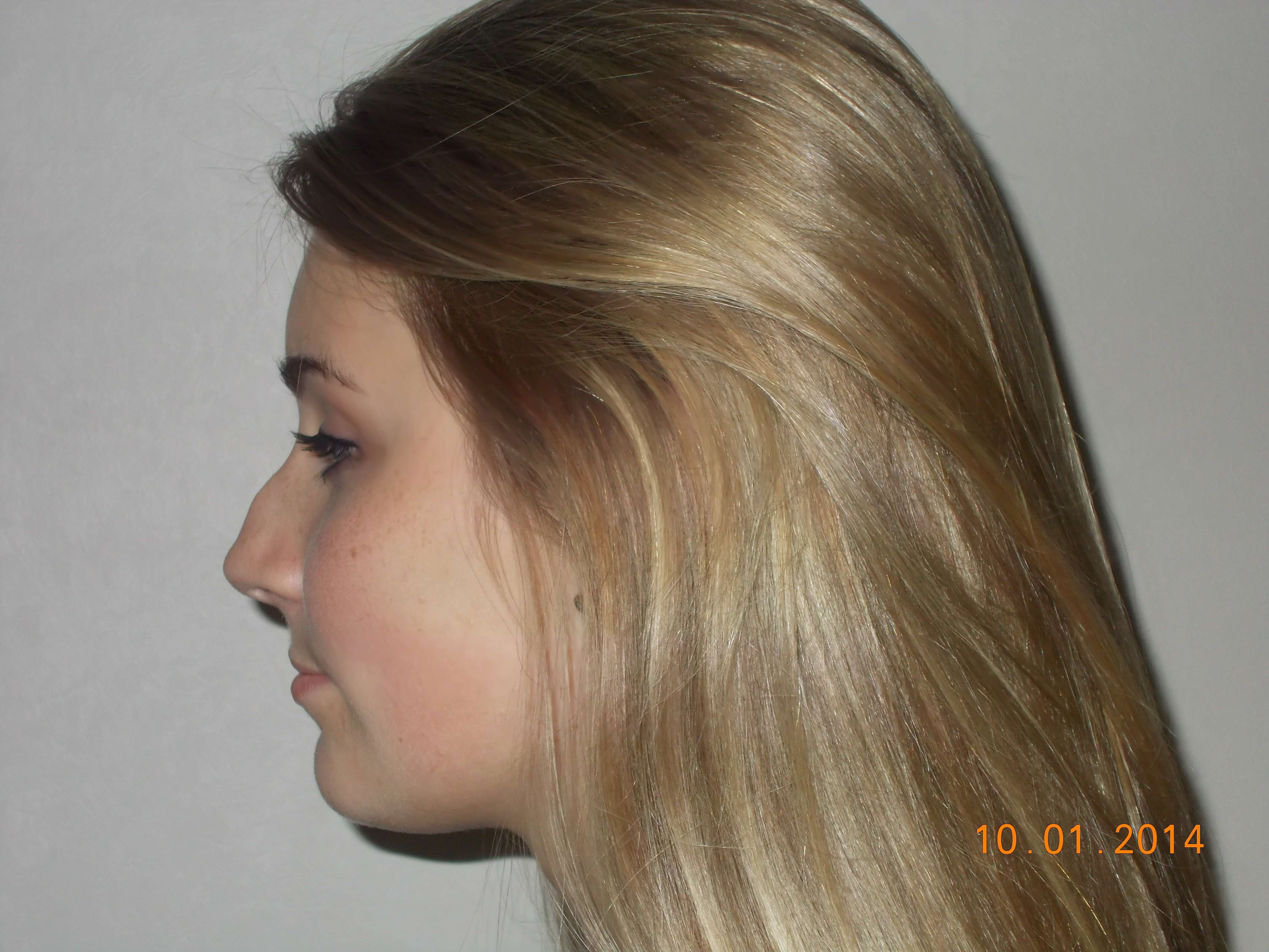 Side View Before