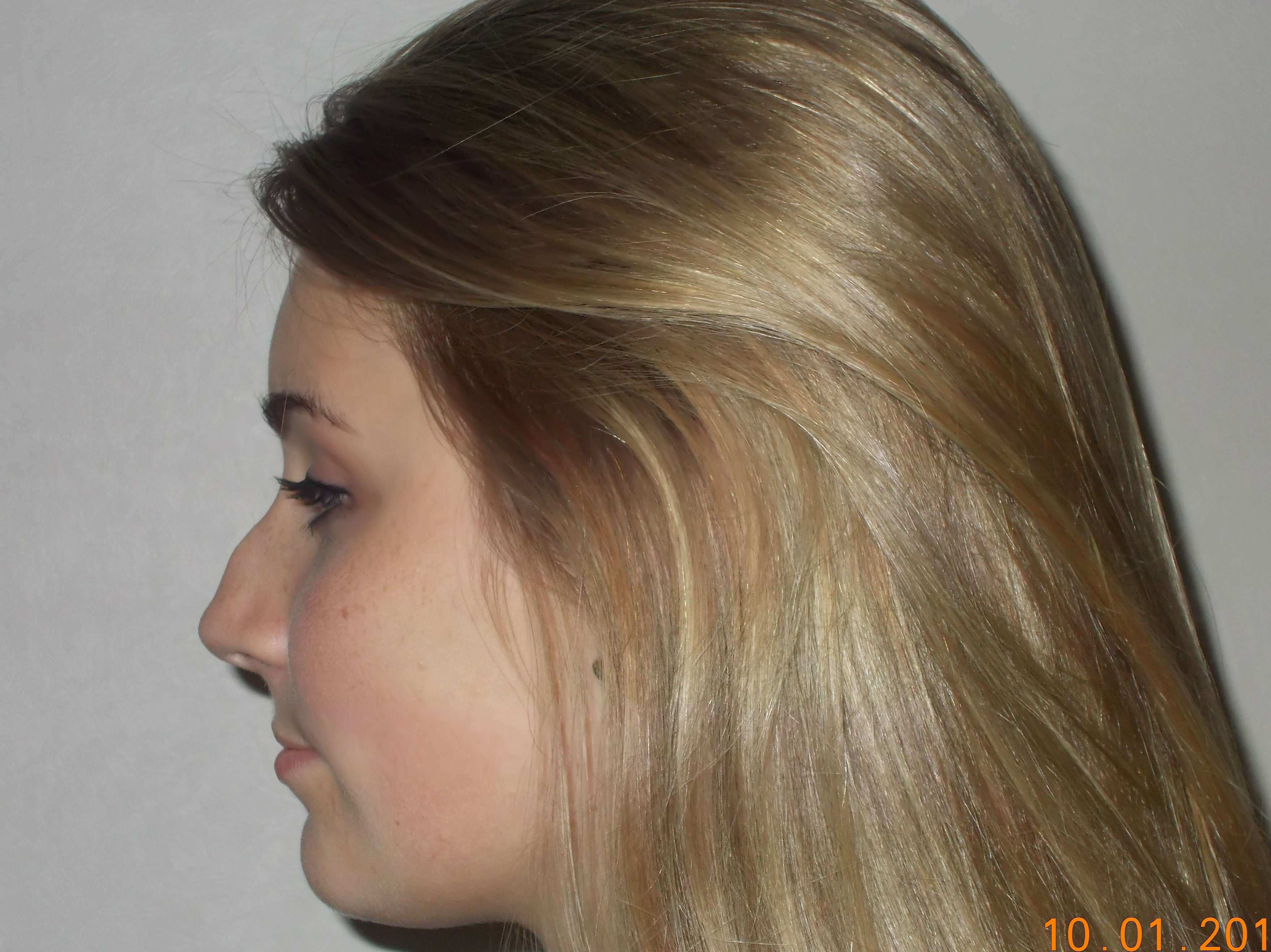 Side View Before