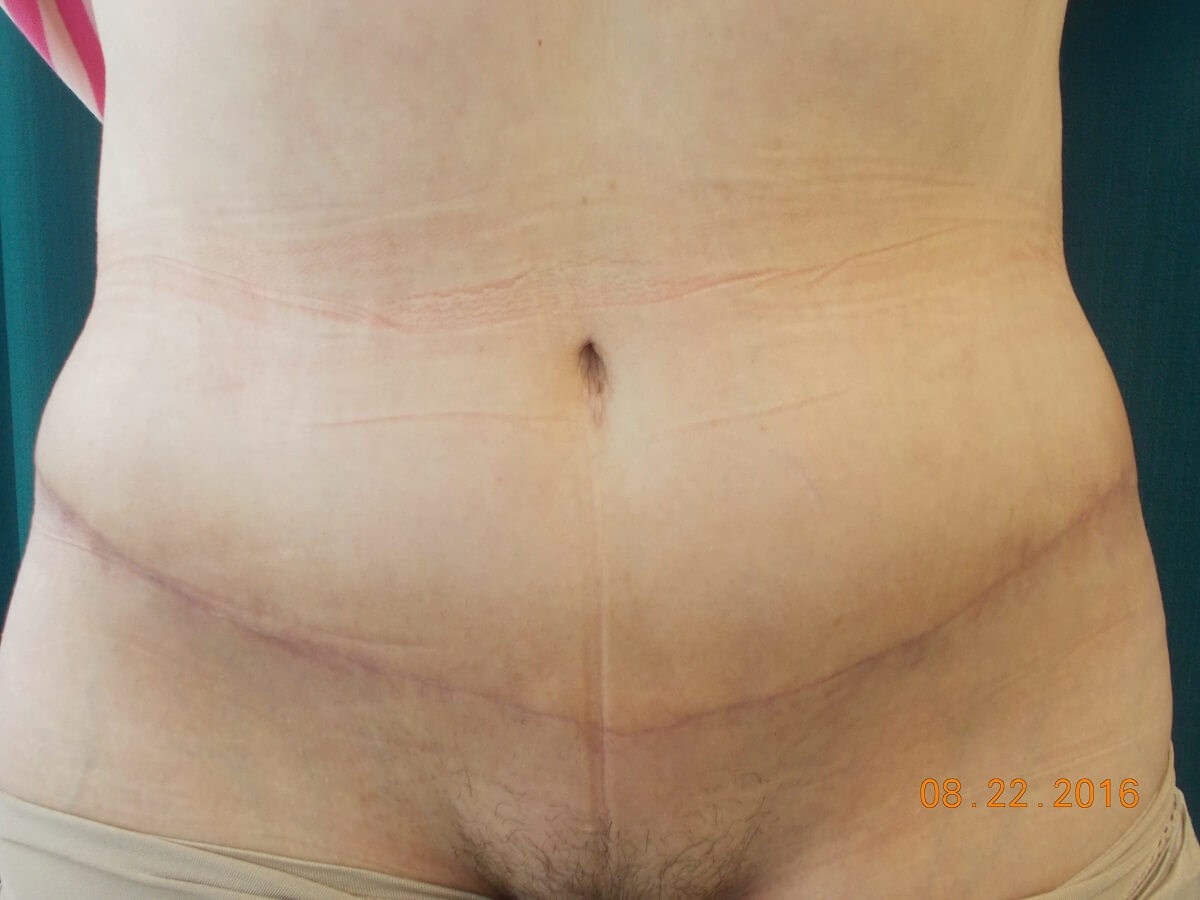 After Image