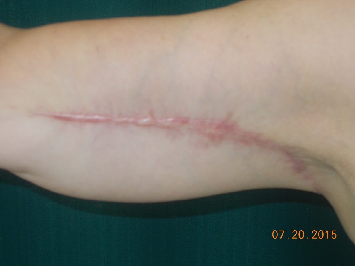 Before Image