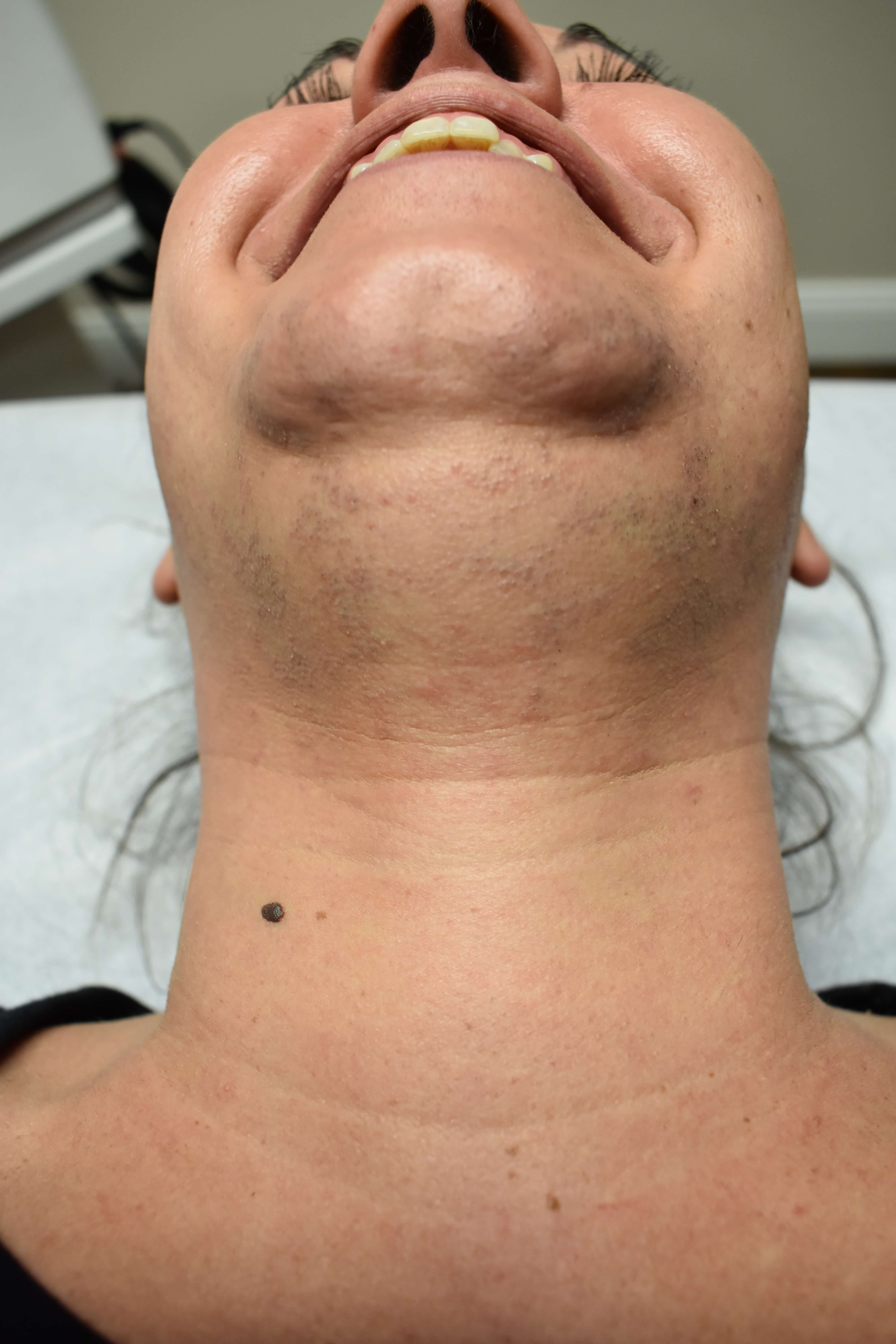 Before Image