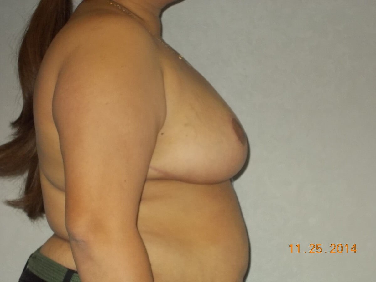 Side View After