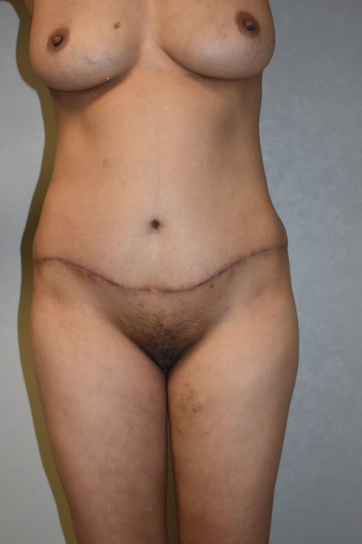 After Image