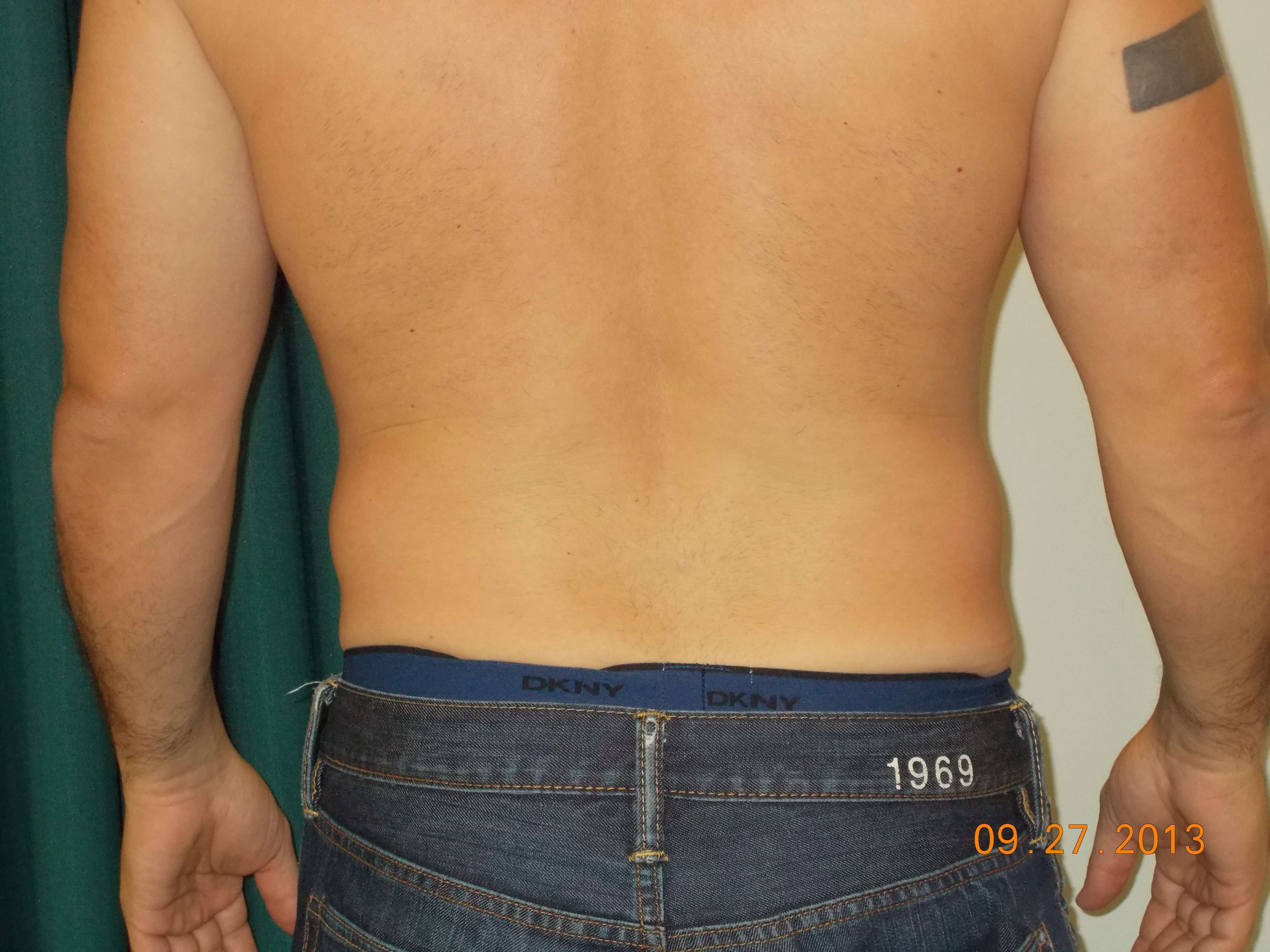 Back View Before