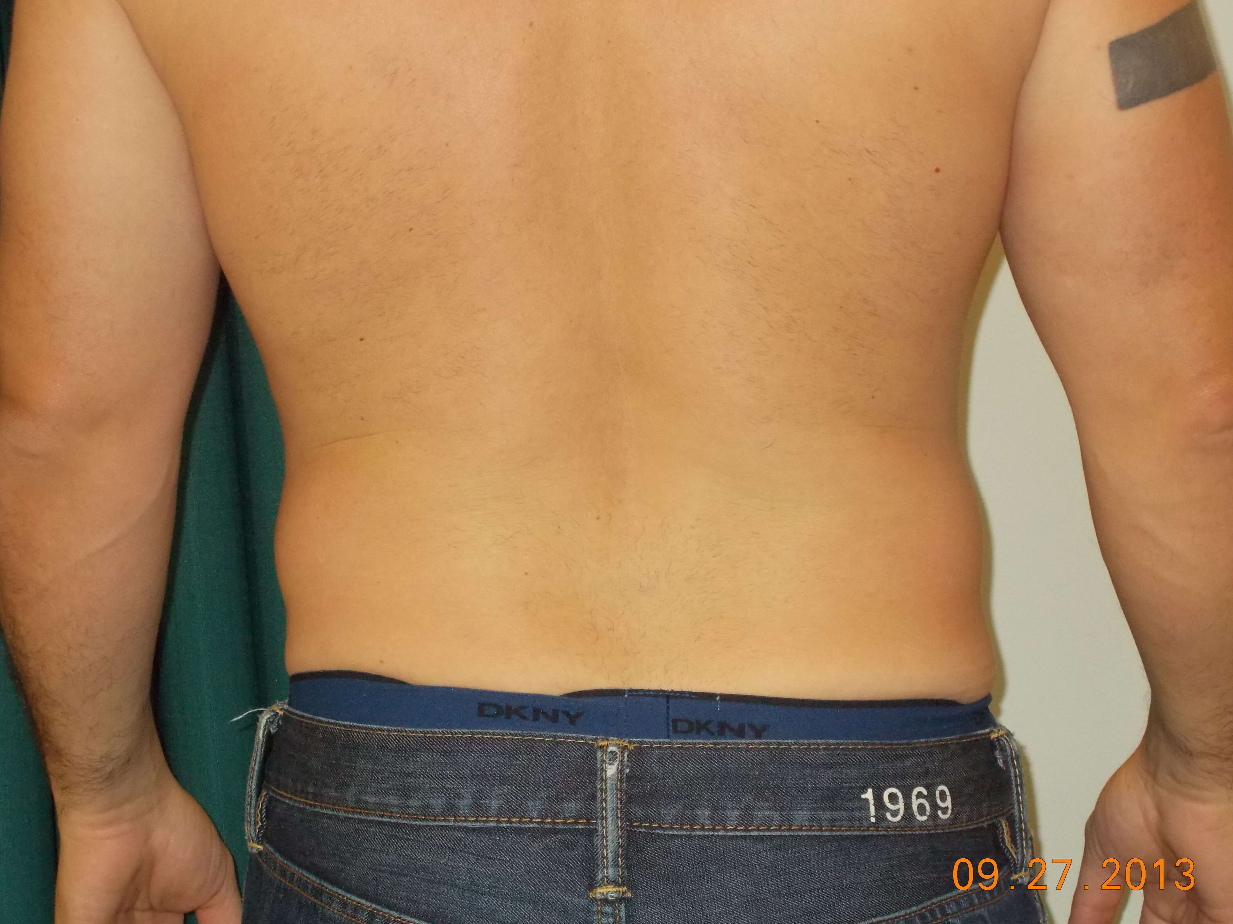 Back View Before
