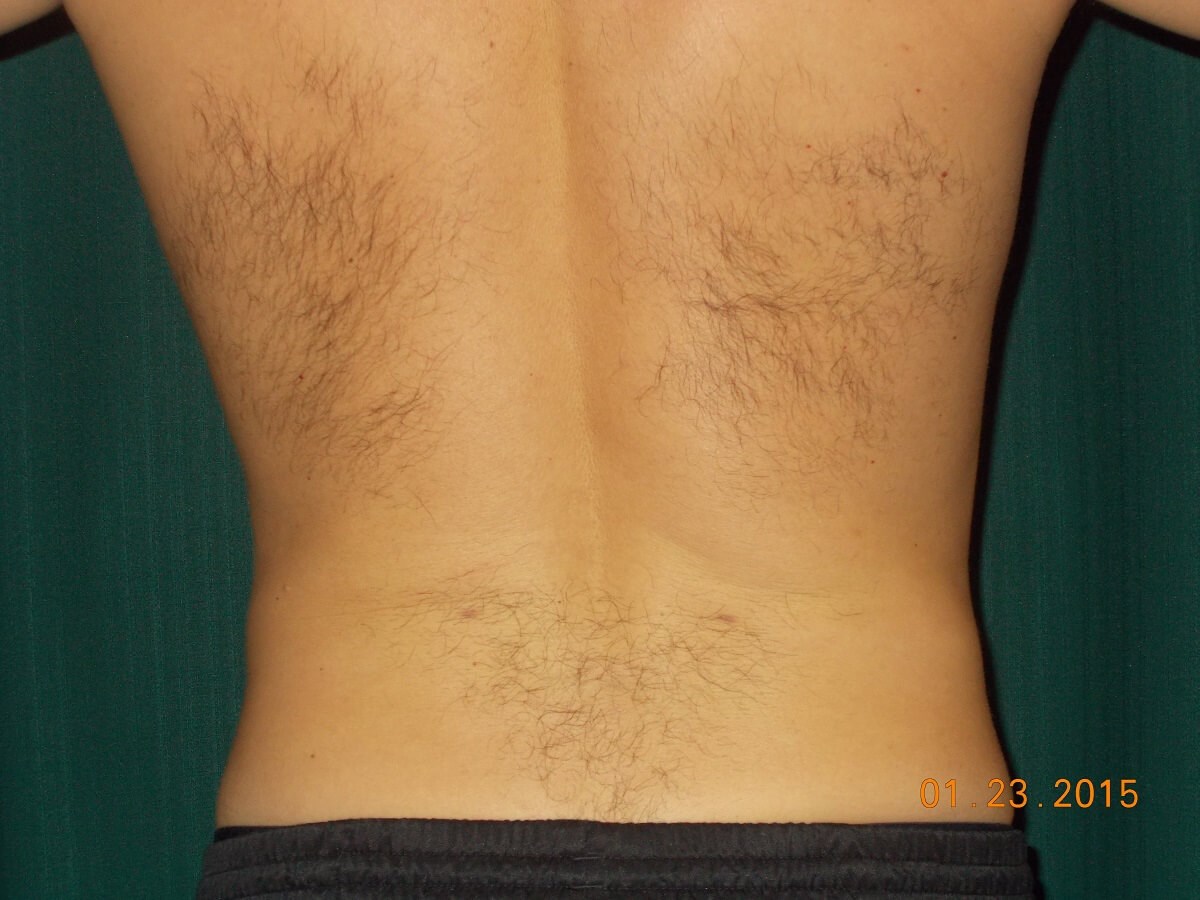 Back View After
