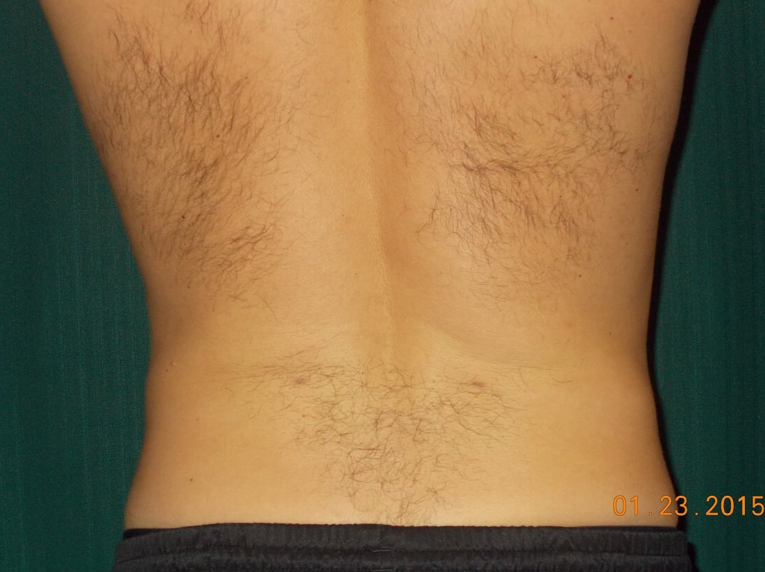 Back View After