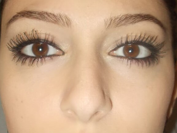 Front View After