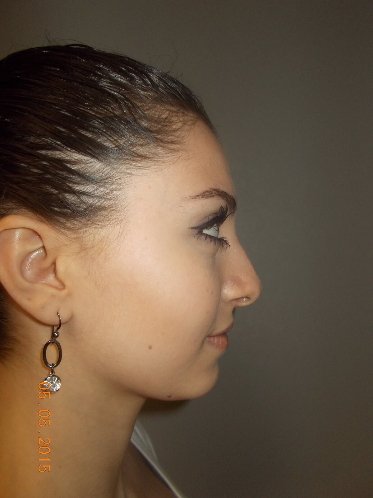 Side View After