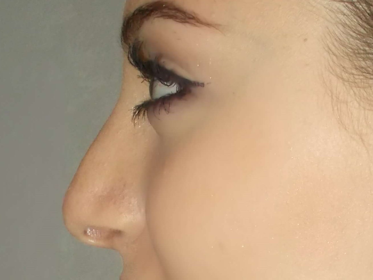 Side View After