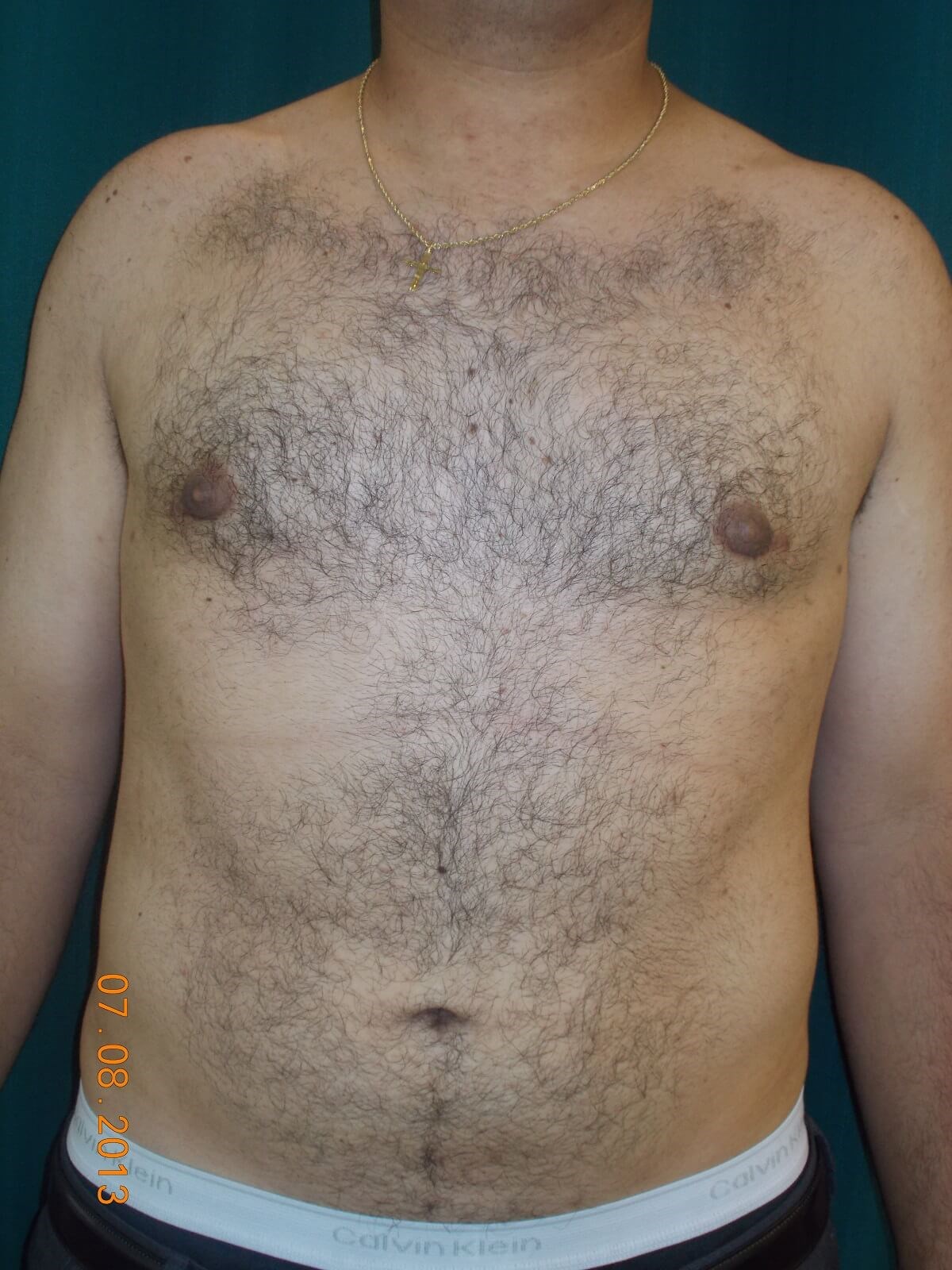 After Image