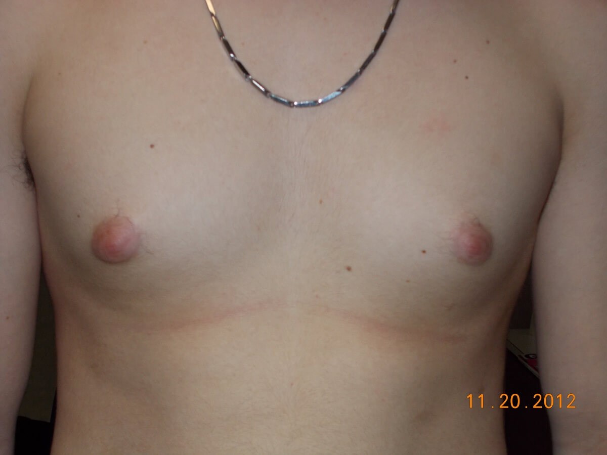Before Image