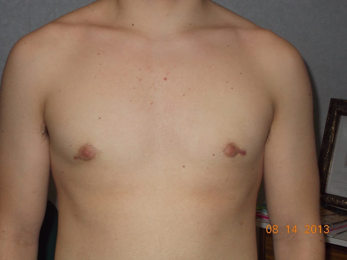 After Image
