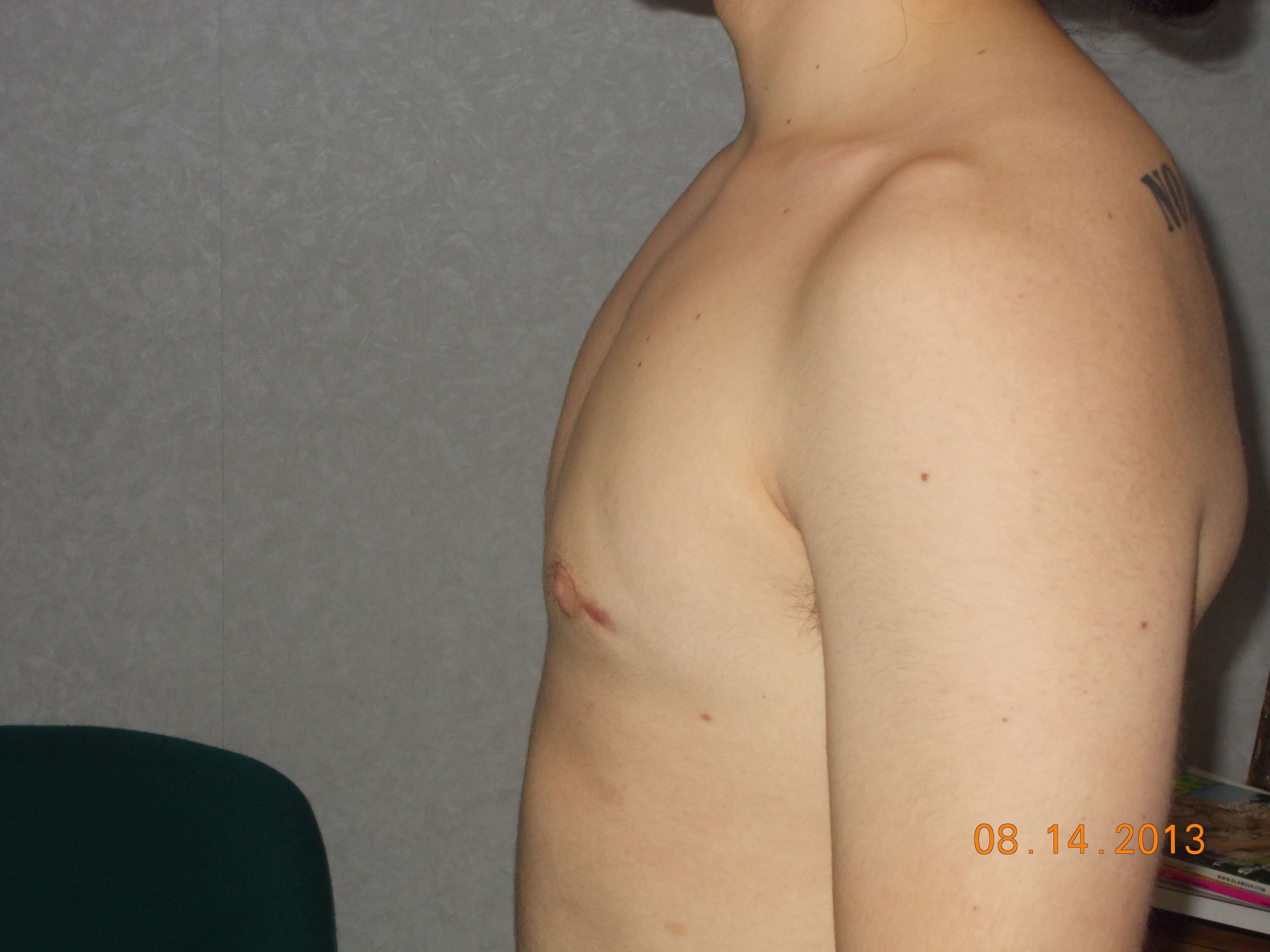 Side View After
