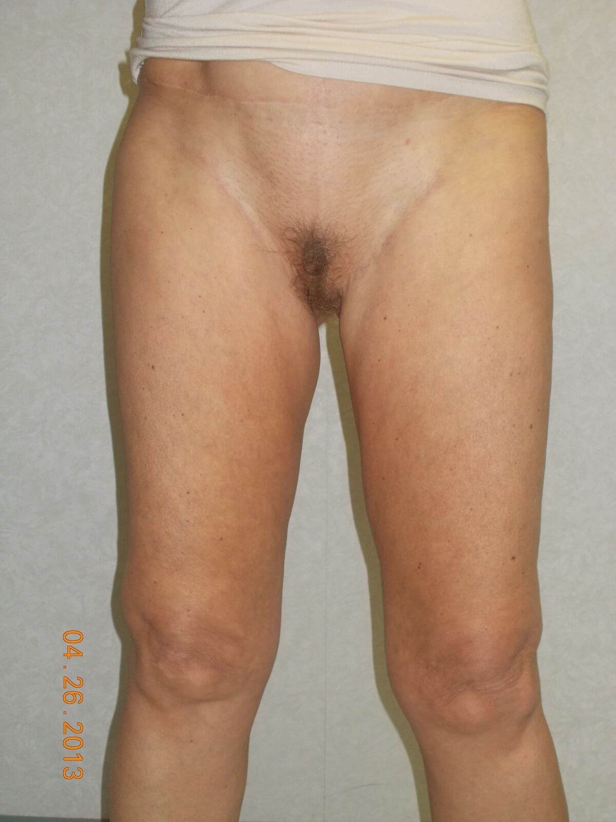 After Image