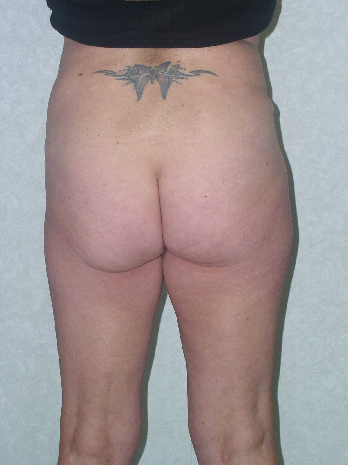 Back View Before