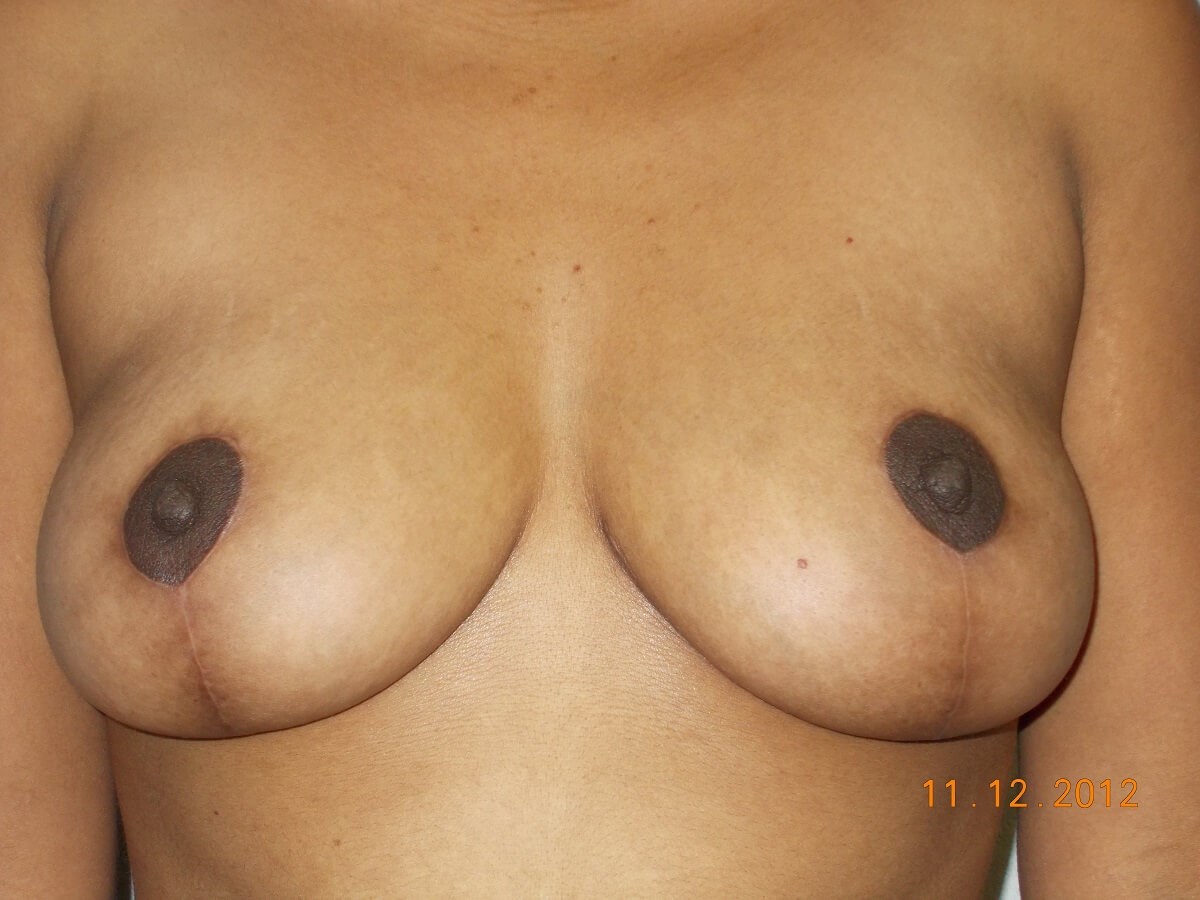 After Image