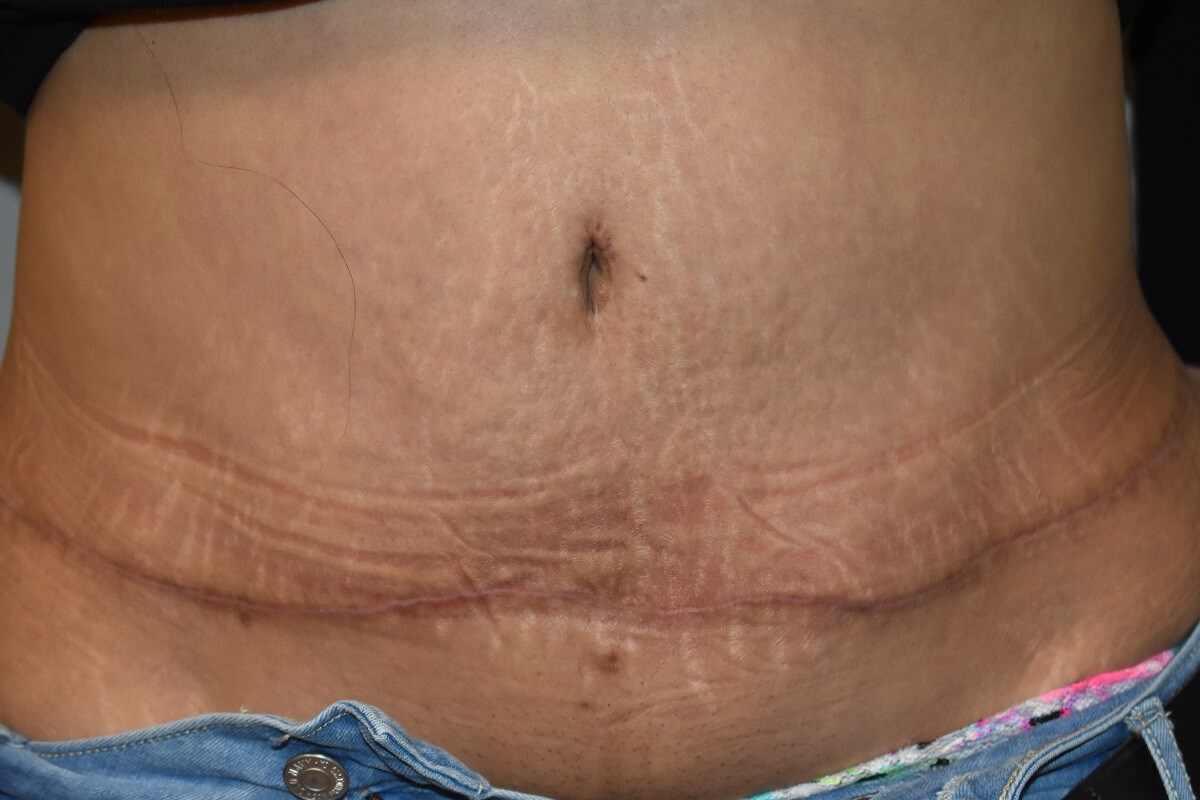 After Image