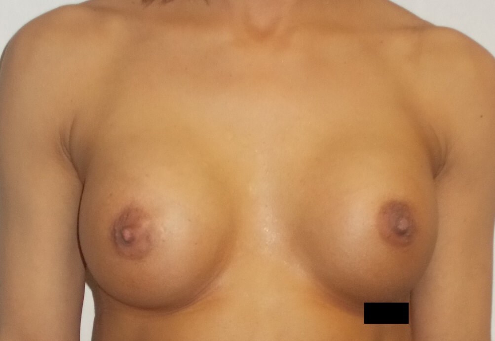 After Image