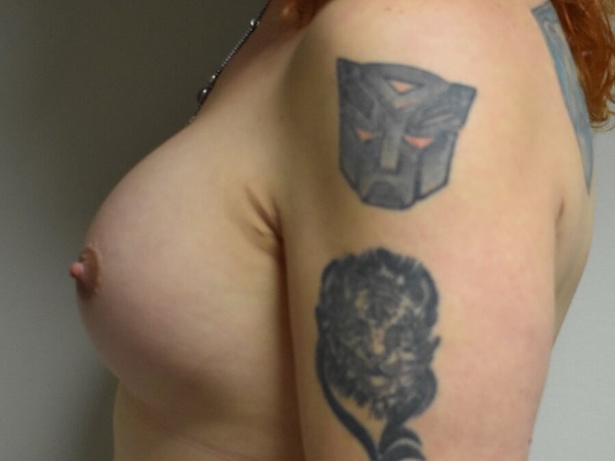Side View After