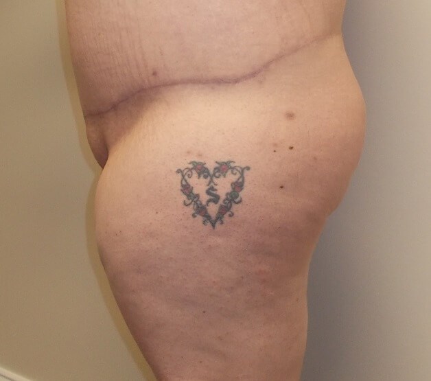 Before Image