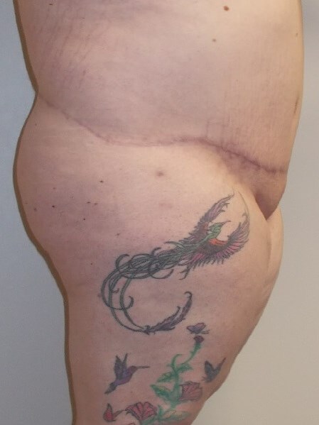 Side View Before