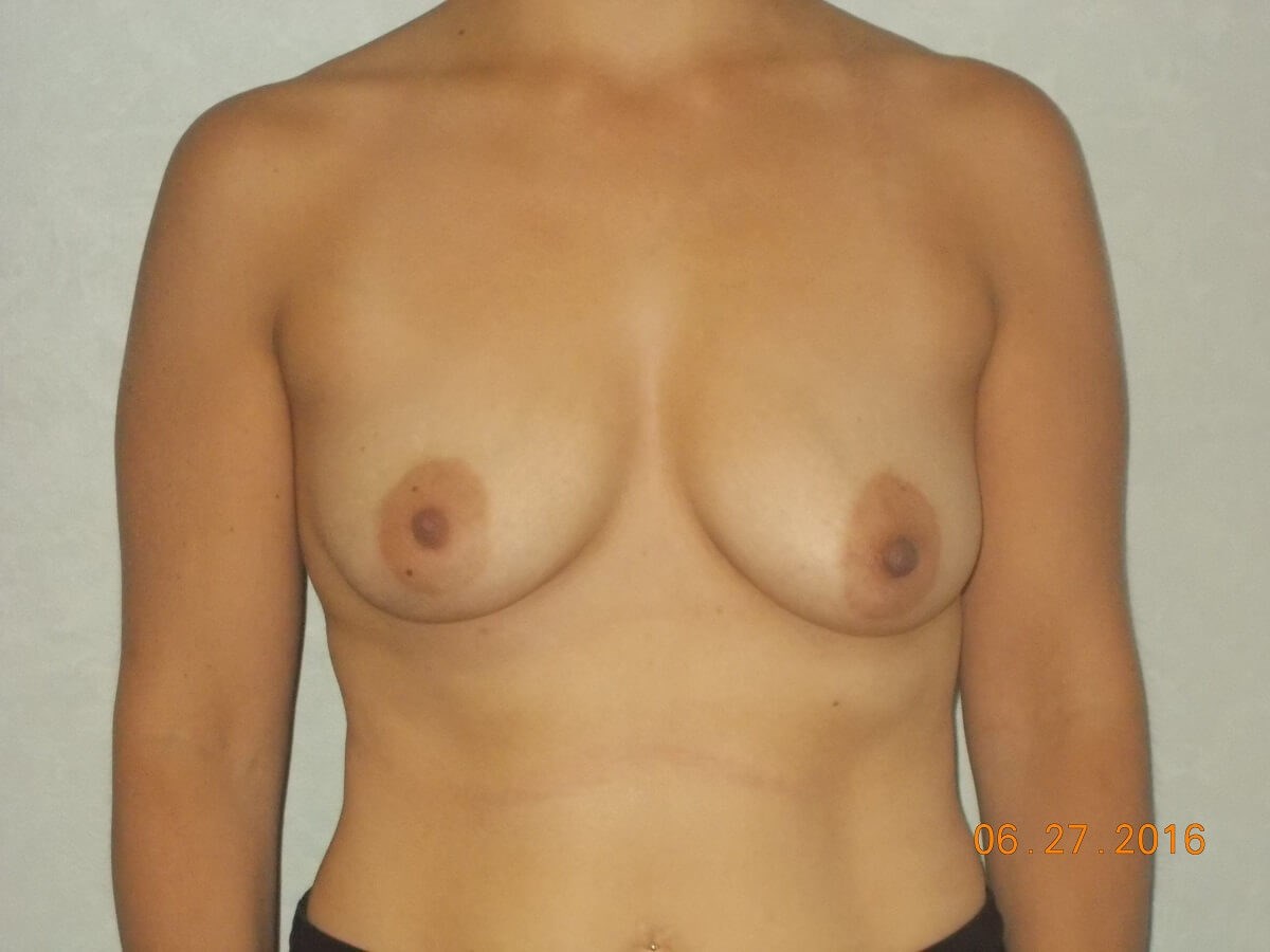 Before Image