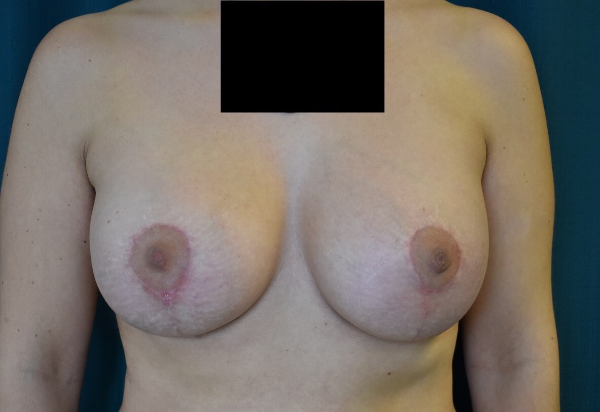 After Image