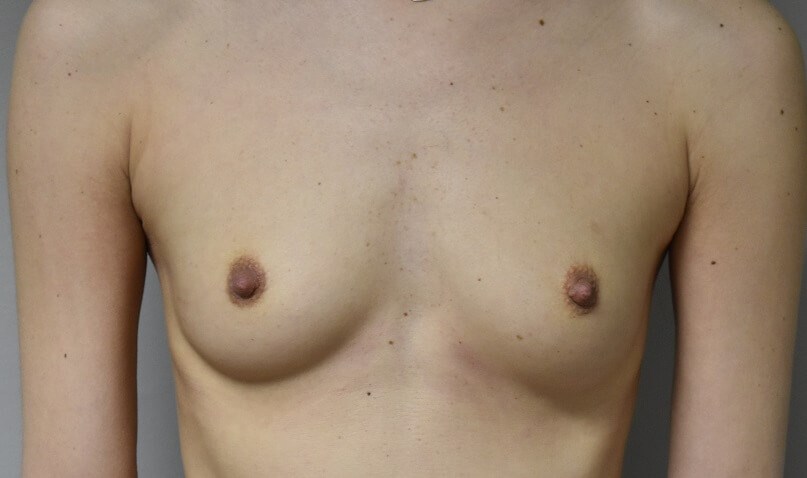 Before Image