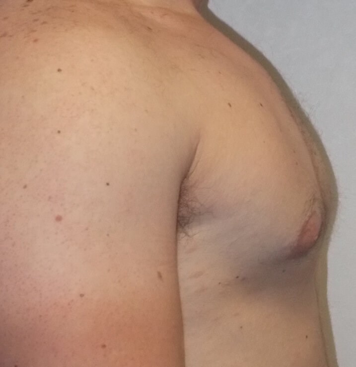 Side View After