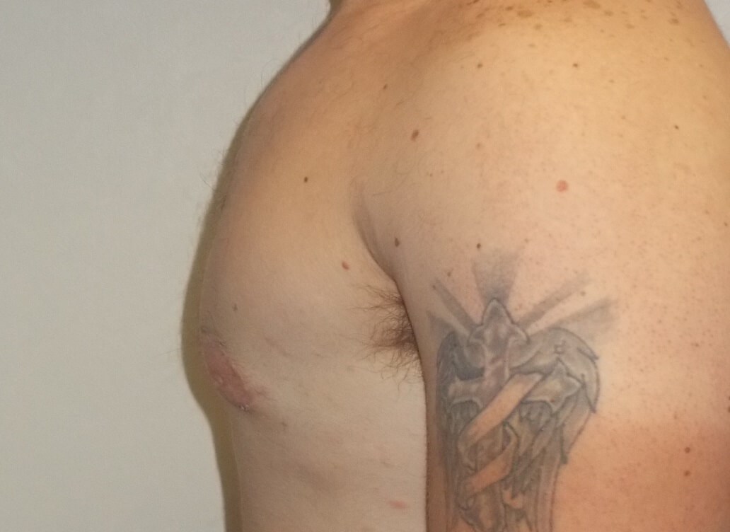 Side View After