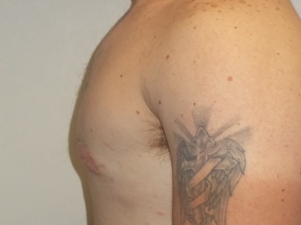 Side View After