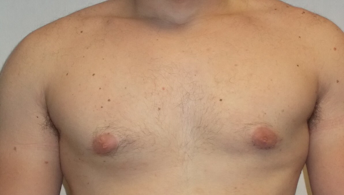 After Image