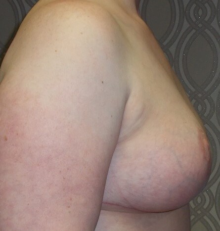 Side View After