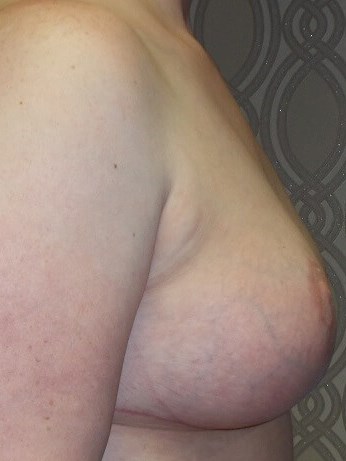 Side View After