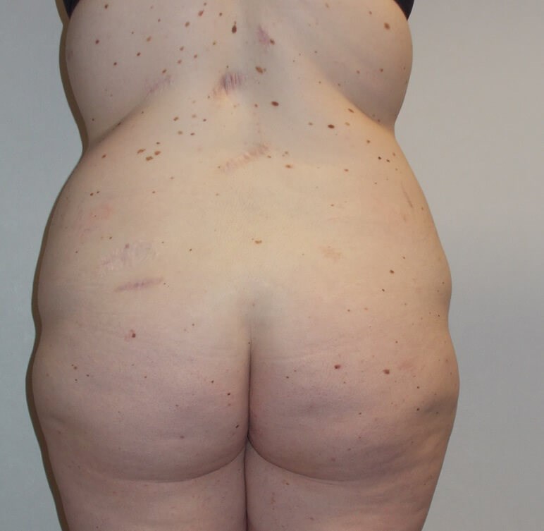 Back View Before