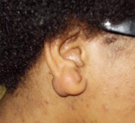 Side View Before