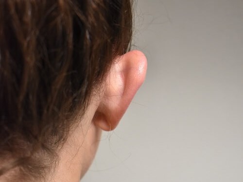 Back View of Right Ear Before