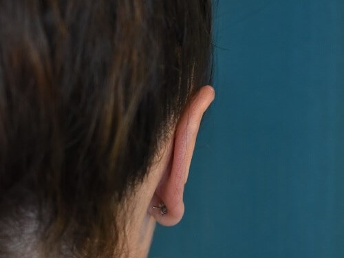 Back View of Right Ear After