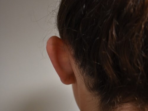 Back View of Left Ear Before