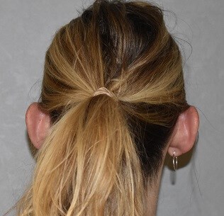 Back View Before