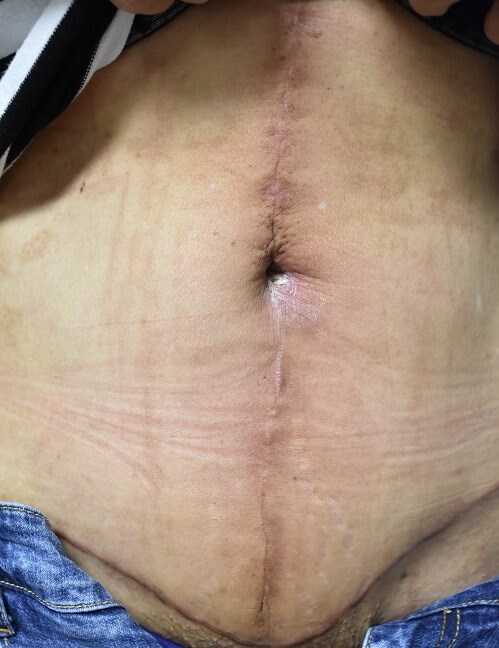 After Image